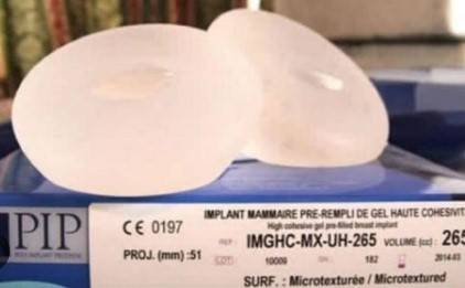 Imagen de la noticia: Francia: Venezolanas con bombas de silicón PIP en sus pechos ganan indemnización histórica