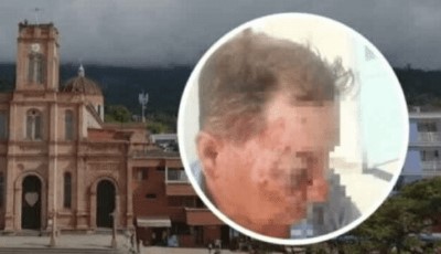 Imagen de la noticia: Colombia: Venezolanos golpearon salvajemente a agricultor que les ofreció trabajo