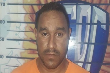 Imagen de la noticia: Estado Anzoátegui: Detenido sujeto señalado de falso odontólogo y montar ortodoncias por 80$