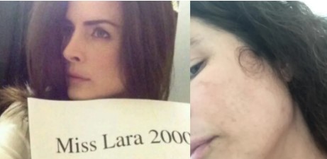 Imagen de la noticia: Estado Lara: Exmiss venezolana está gravemente enferma y en la calle: “Ya no aguanto mi vida”