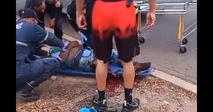 Imagen de la noticia: Municipio Maracaibo: Motociclista muere tras perder la pierna en accidente