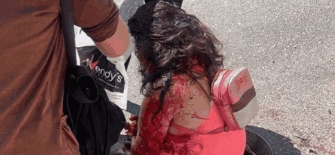 Imagen de la noticia: Municipio Maracaibo: Mujer resultó gravemente herida al ser atacada con un «pico e botella» por su esposo