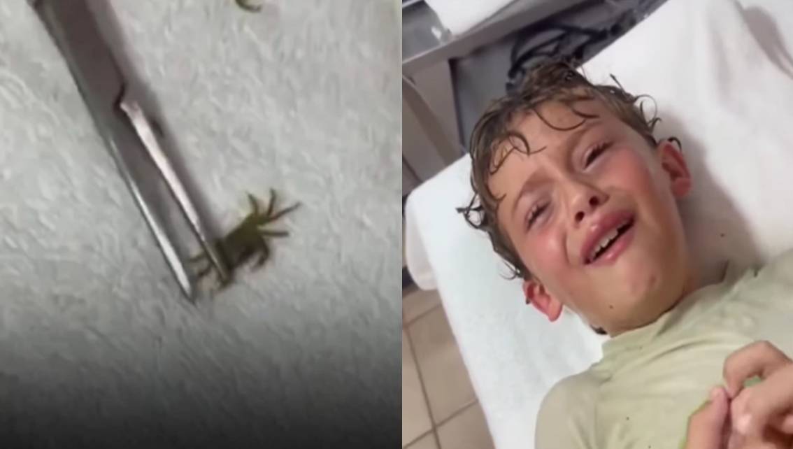 Imagen de la noticia: Le extrajeron un cangrejo vivo del oído a un niño en México