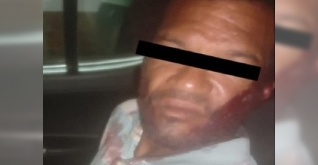 Imagen de la noticia: Tragedia en Guacara: Hombre es asesinado a puñaladas en plena vía pública