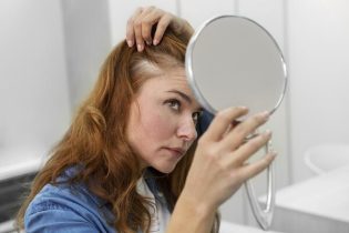 Imagen de la noticia: ¿Se te cae mucho el cabello? Estos alimentos clave pueden frenar la pérdida