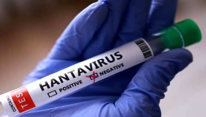 Academia Nacional de Medicina descarta ‘alerta sanitaria’ por hantavirus en Venezuela