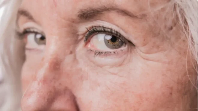 Imagen de la noticia: Suaviza las arrugas de tu rostro con este simple ingrediente: una opción natural y efectiva
